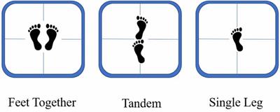 Effective utilization of attentional resources in postural control in athletes of skill-oriented sports: an event-related potential study